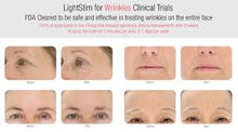 Load image into Gallery viewer, LightStim for Wrinkles