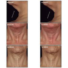 Load image into Gallery viewer, SkinCeuticals Tripeptide-R Neck Repair
